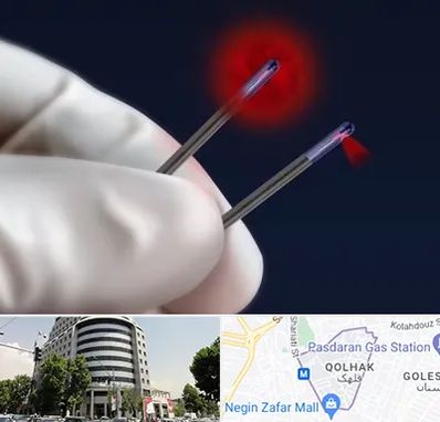 جراحی سینه با لیزر در قلهک 