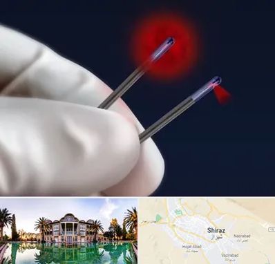 جراحی سینه با لیزر در شیراز