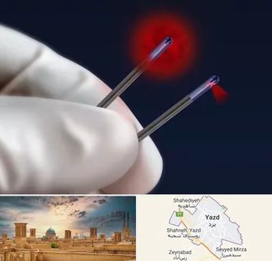 جراحی سینه با لیزر در یزد