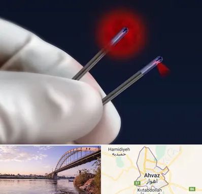 جراحی سینه با لیزر در اهواز