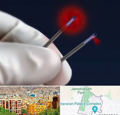 جراحی سینه با لیزر در نیاوران 