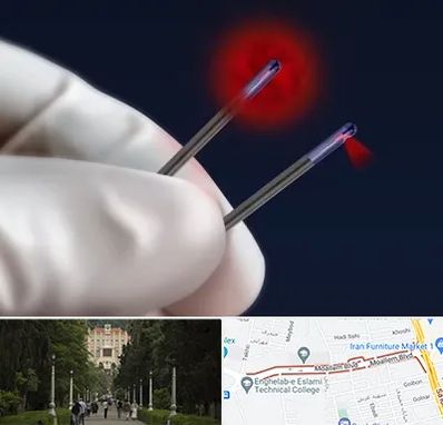 جراحی سینه با لیزر در بلوار معلم رشت 