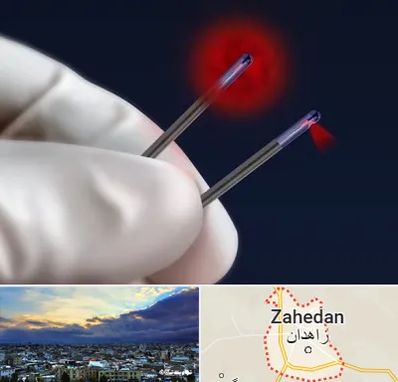 جراحی سینه با لیزر در زاهدان