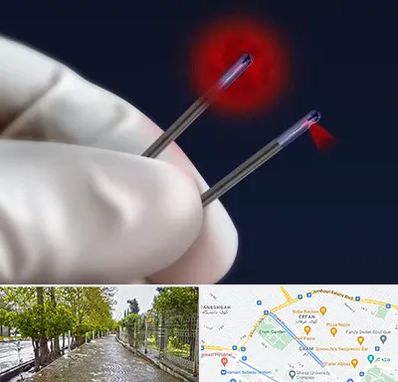 جراحی سینه با لیزر در خیابان ارم شیراز