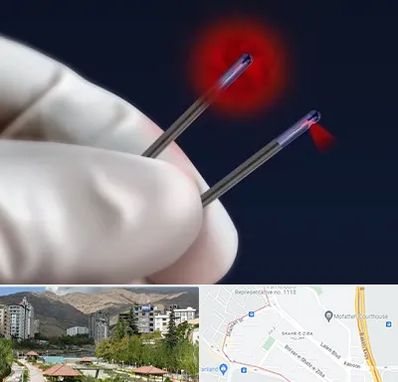 جراحی سینه با لیزر در شهر زیبا 