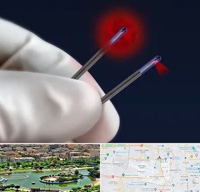 جراحی سینه با لیزر در منطقه 9 تهران 