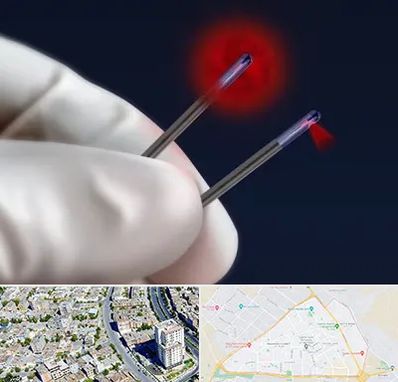 جراحی سینه با لیزر در قاسم آباد مشهد