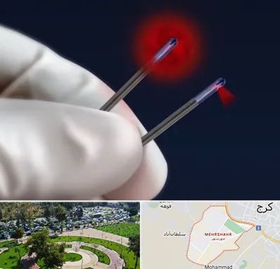 جراحی سینه با لیزر در مهرشهر کرج 