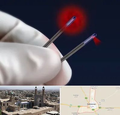 جراحی سینه با لیزر در سبزوار