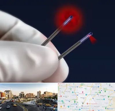 جراحی سینه با لیزر در منطقه 7 تهران 