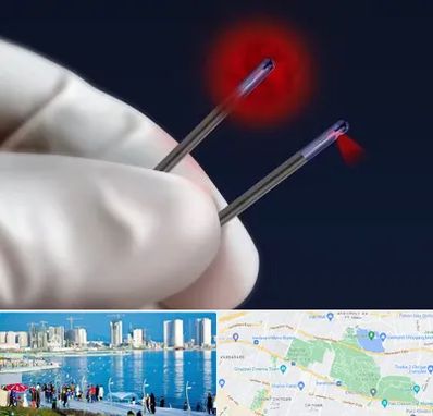 جراحی سینه با لیزر در چیتگر 