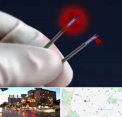 جراحی سینه با لیزر در بلوار سجاد مشهد