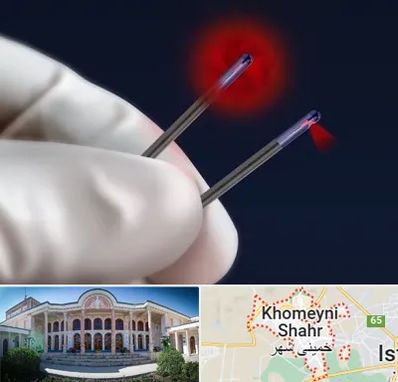 جراحی سینه با لیزر در خمینی شهر