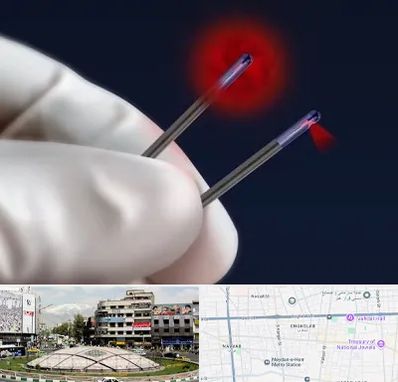 جراحی سینه با لیزر در مرکز تهران