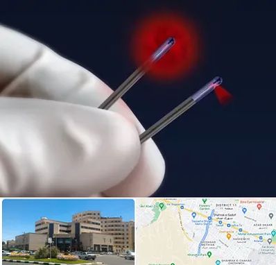 جراحی سینه با لیزر در صیاد شیرازی مشهد