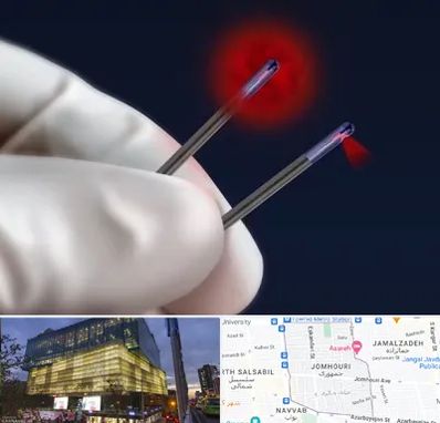 جراحی سینه با لیزر در جمهوری 