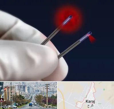 جراحی سینه با لیزر در گوهردشت کرج 