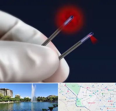 جراحی سینه با لیزر در کوهسنگی مشهد