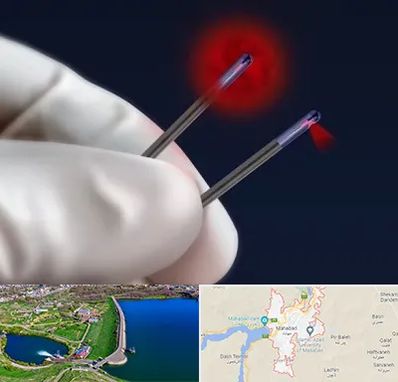 جراحی سینه با لیزر در مهاباد