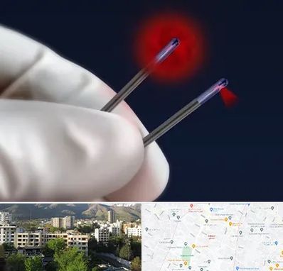 جراحی سینه با لیزر در دیباجی 