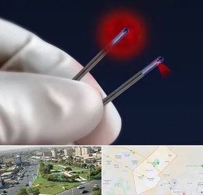 جراحی سینه با لیزر در کمال شهر کرج