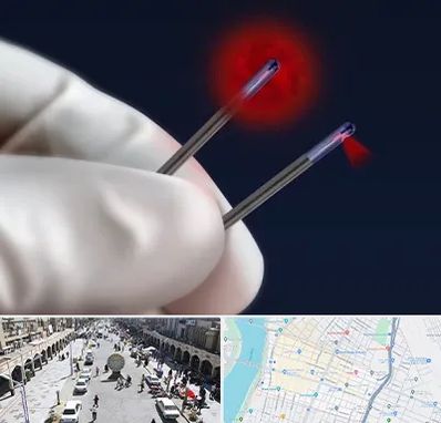 جراحی سینه با لیزر در نادری اهواز