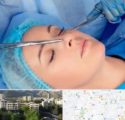 عمل بینی نیمه فانتزی در دیباجی 