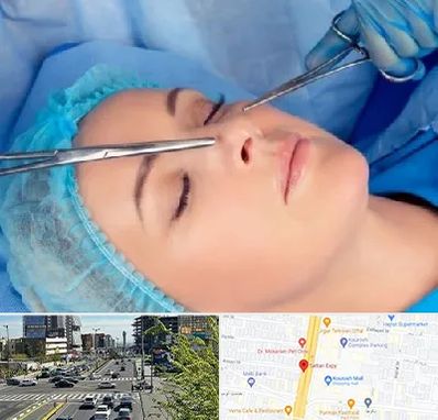 عمل بینی نیمه فانتزی در ستاری 