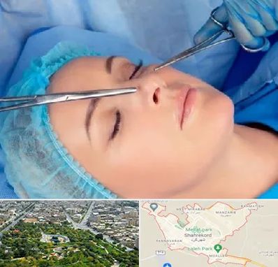 عمل بینی نیمه فانتزی در شهرکرد