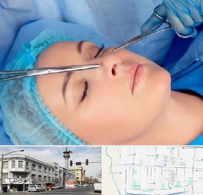 عمل بینی نیمه فانتزی در 17شهریور