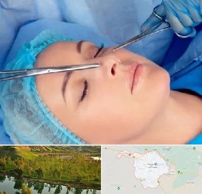 عمل بینی نیمه فانتزی در بهبهان