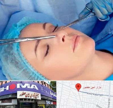 عمل بینی نیمه فانتزی در امین حضور