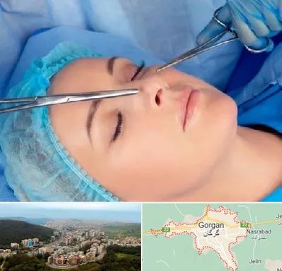 عمل بینی نیمه فانتزی در گرگان
