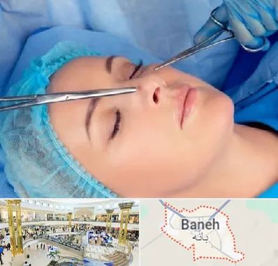عمل بینی نیمه فانتزی در بانه