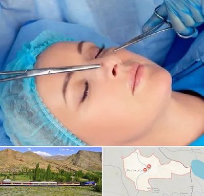 عمل بینی نیمه فانتزی در خاش