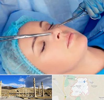 عمل بینی نیمه فانتزی در مرودشت