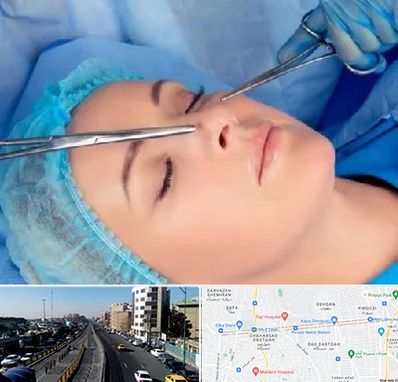 عمل بینی نیمه فانتزی در پیروزی 