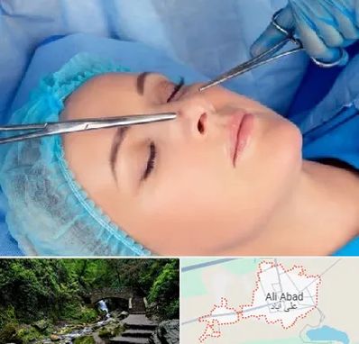 عمل بینی نیمه فانتزی در علی آباد کتول