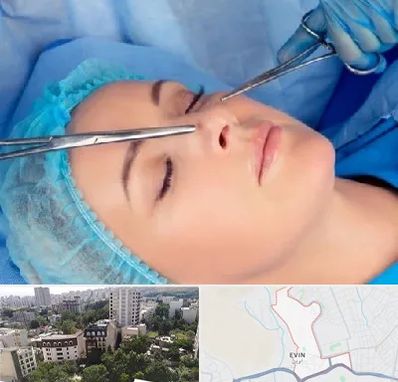 عمل بینی نیمه فانتزی در اوین