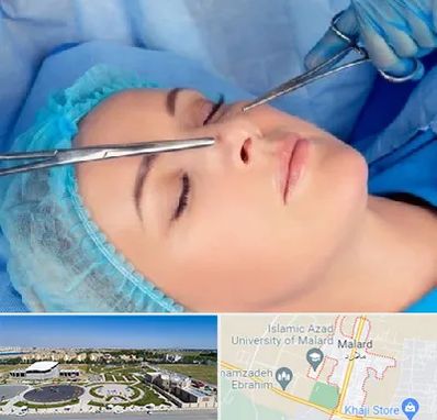 عمل بینی نیمه فانتزی در ملارد