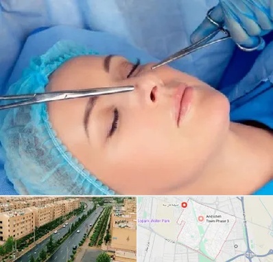 عمل بینی نیمه فانتزی در فاز سه اندیشه