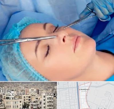 عمل بینی نیمه فانتزی در اسکندری