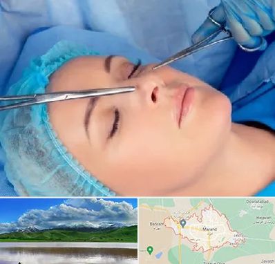 عمل بینی نیمه فانتزی در مرند