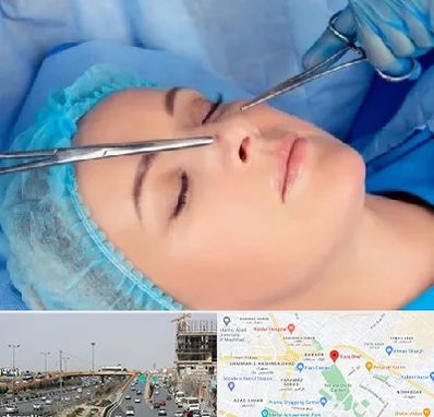 عمل بینی نیمه فانتزی در بلوار توس مشهد