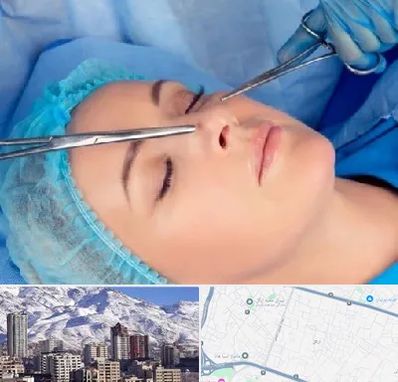 عمل بینی نیمه فانتزی در ازگل