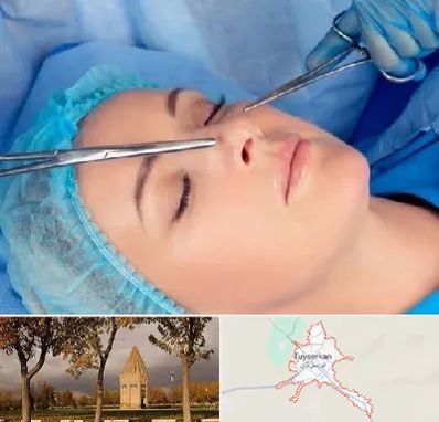 عمل بینی نیمه فانتزی در تویسرکان