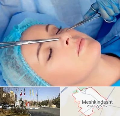 عمل بینی نیمه فانتزی در مشکین دشت