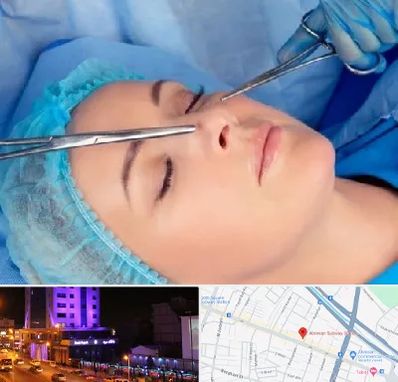 عمل بینی نیمه فانتزی در آبرسان تبریز