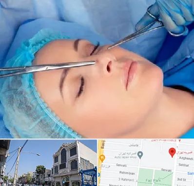 عمل بینی نیمه فانتزی در افسریه 