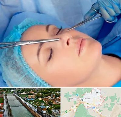 عمل بینی نیمه فانتزی در مراغه